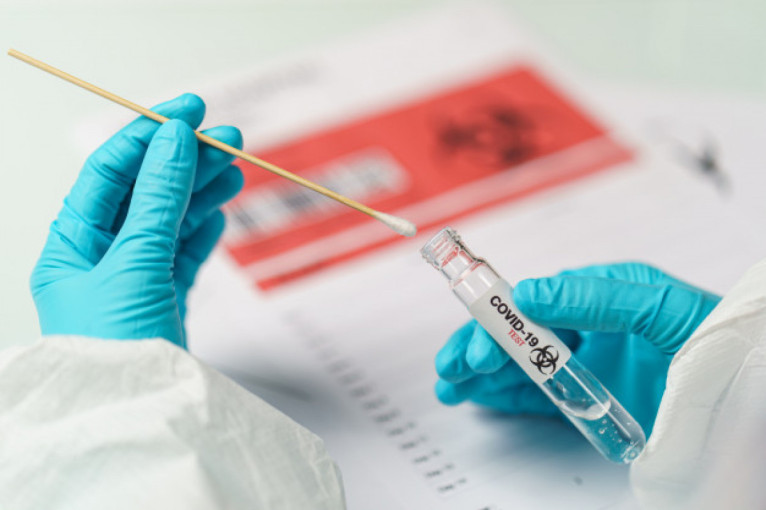 Epidemiologai: atliktas testas nereiškia, jog ramiai galite sėstis prie šventinio stalo