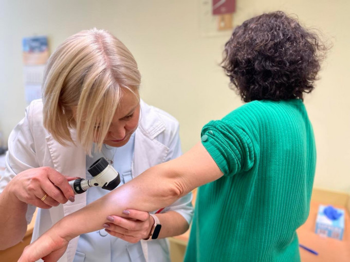 KULIG: melanoma suserga vis jaunesni žmonės