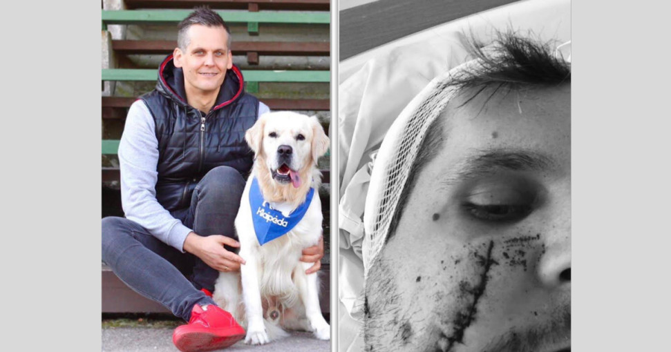 Brutalus užpuolikas pasikėsino į klaipėdiečio mokytojo Nerijaus gyvybę